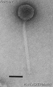 Image of phage under microscope