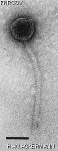 HER388 Image of phage under microscope