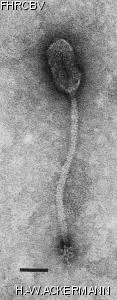 HER392 Image of phage under microscope
