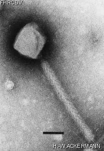 HER393 Image of phage under microscope