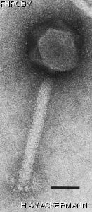 HER394 Image of phage under microscope