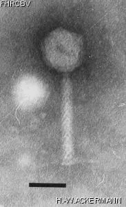 Image of phage under microscope