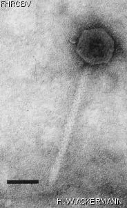 HER397 Image of phage under microscope