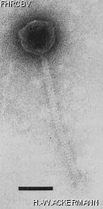HER399 Image of phage under microscope