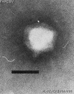 HER400 Image of phage under microscope