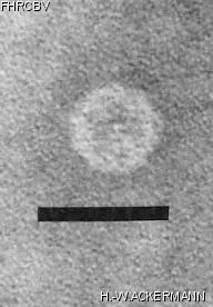 HER403 Image of phage under microscope