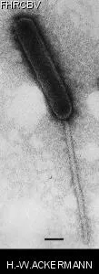 HER408 Image of phage under microscope
