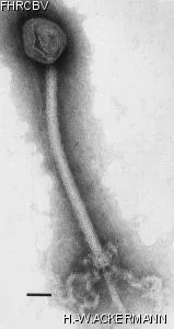 Image of phage under microscope
