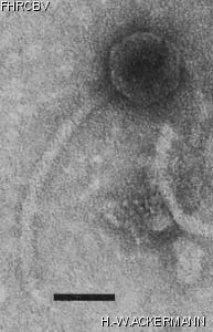 HER417 Image of phage under microscope