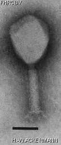 HER422 Image of phage under microscope