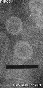 HER424 Image of phage under microscope