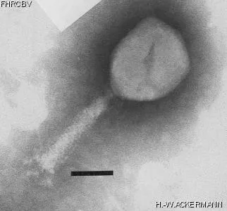 HER43 Image of phage under microscope