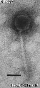 HER445 Image of phage under microscope