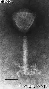 HER447 Image of phage under microscope