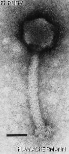 HER48 Image of phage under microscope