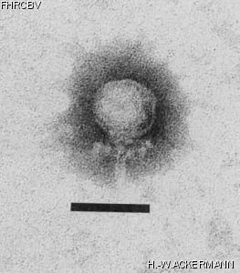 HER49 Image of phage under microscope