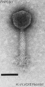 HER50 Image of phage under microscope