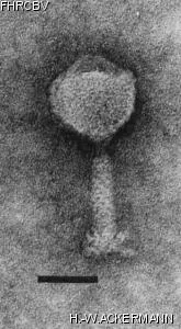 HER52 Image of phage under microscope