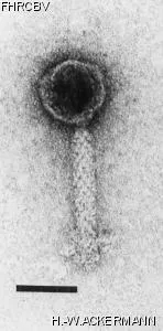 HER65 Image of phage under microscope