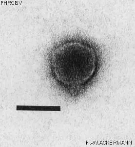 HER71 Image of phage under microscope
