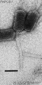 HER78 Image of phage under microscope