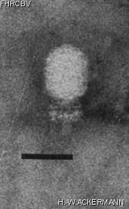 HER80 Image of phage under microscope
