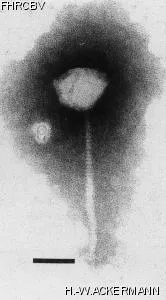 HER83 Image of phage under microscope