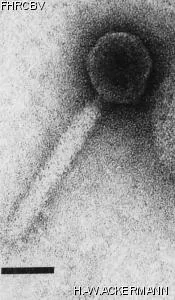 HER84 Image of phage under microscope
