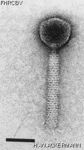 HER87 Image of phage under microscope