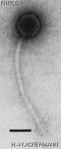 HER90 Image of phage under microscope