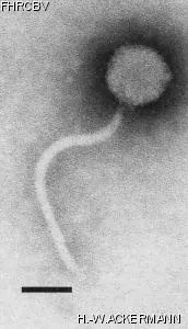 HER91 Image of phage under microscope