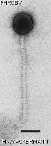 HER92 Image of phage under microscope