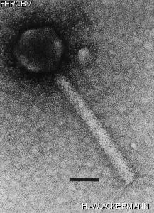 HER93 Image of phage under microscope