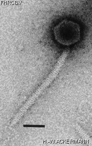 HER95 Image of phage under microscope
