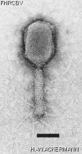 HER98 Image of phage under microscope