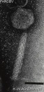 HER99 Image of phage under microscope